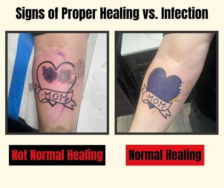 tattoo peeling