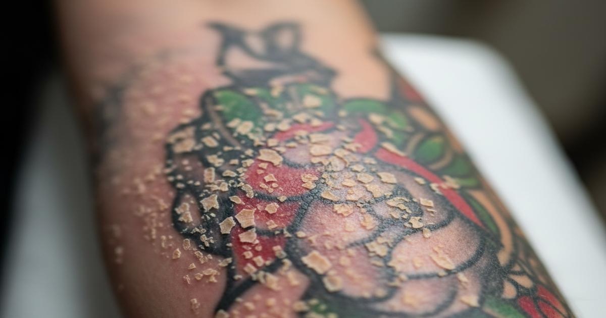 tattoo peeling