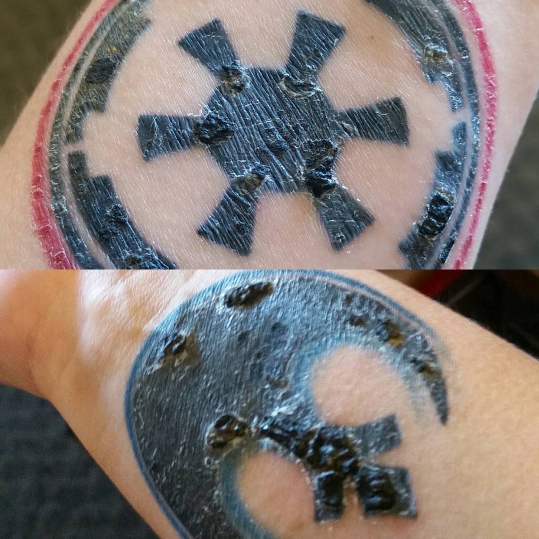 tattoo scabbing