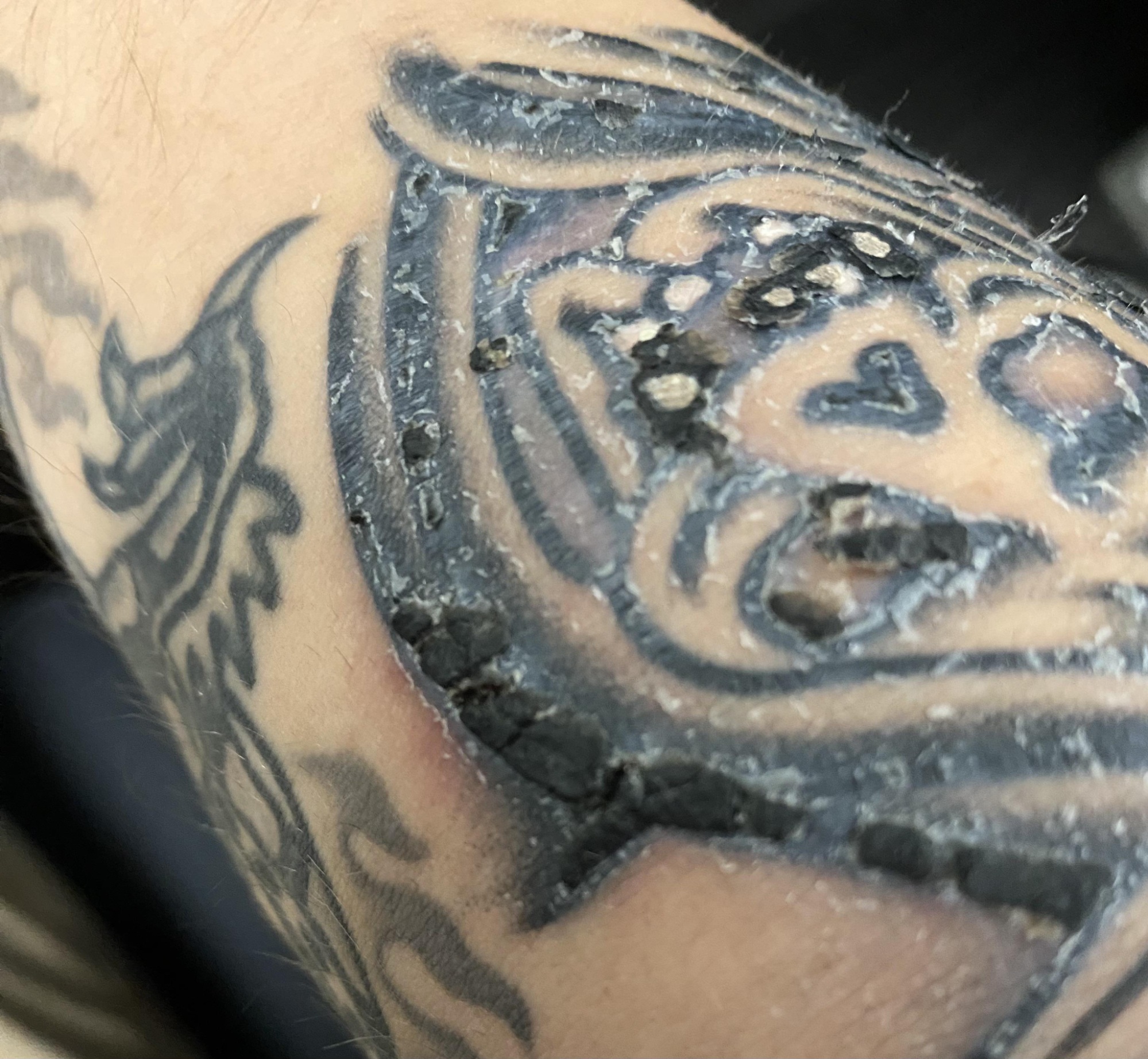 tattoo scabbing